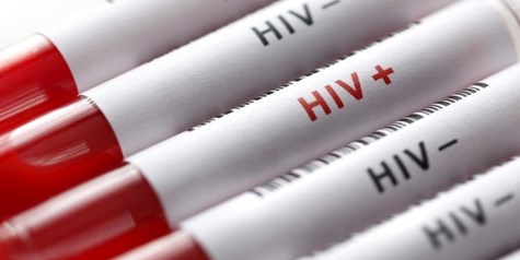 شناسایی 25000 مبتلا به HIV در ایران/ ایدز؛ از راه‌های پیشگیری تا درمان رایگان